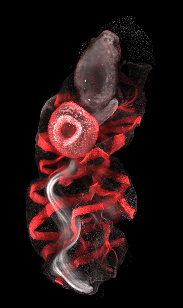 A translucent blob containing one circular, donut-like object and many ribbon-like strands, stained red, on a black background.