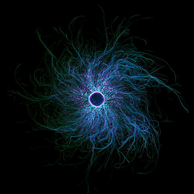 A round cell with many thin protrusions, stained blue and purple, spiralling outward, is displayed on a black background.