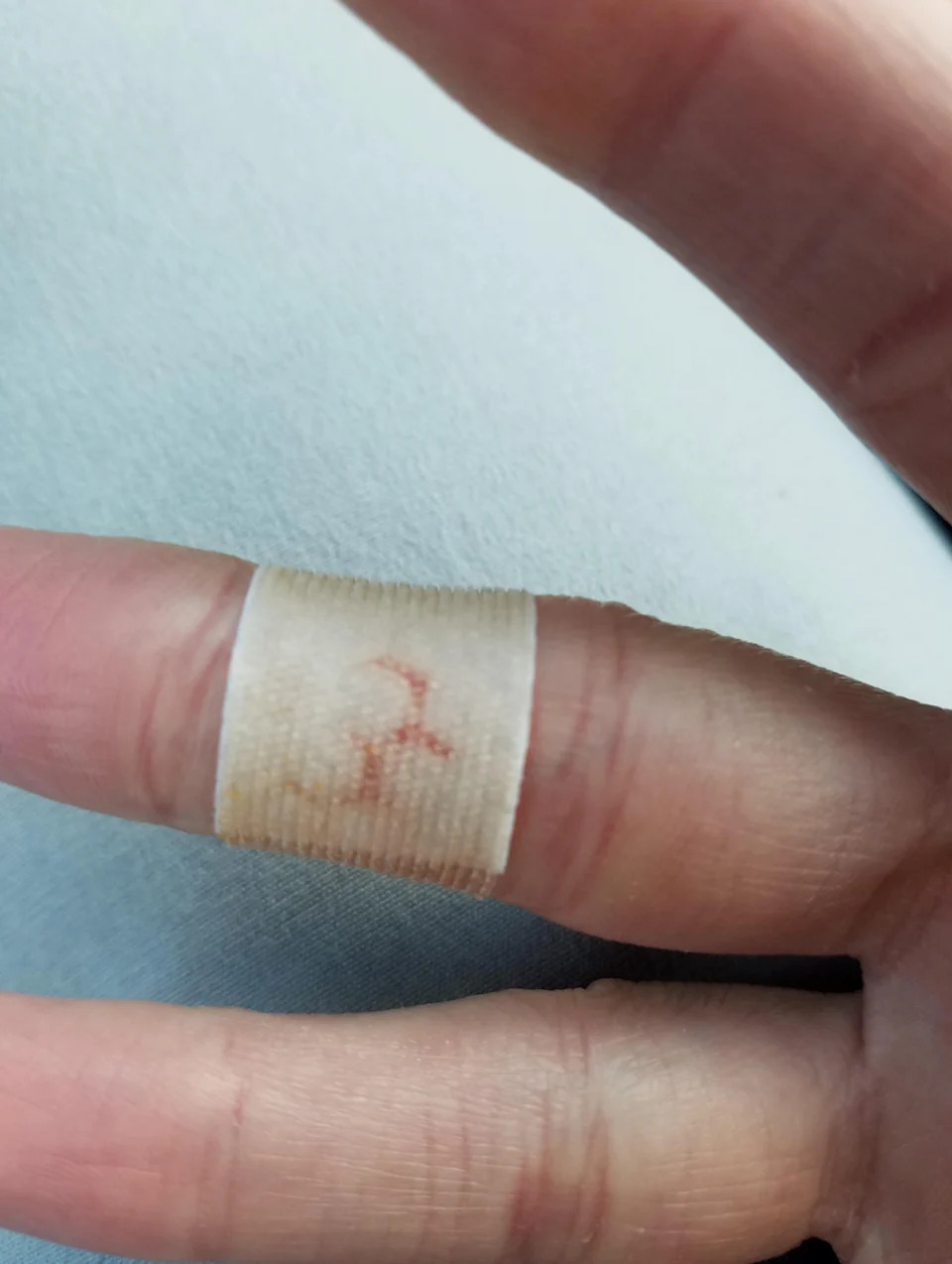 A bandaged finger with a small bloodstain on the bandage is shown close-up