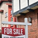 Why young women are having facelifts: ‘I couldn’t even open my eyes. That’s how swollen I was’ | Cosmetic surgery