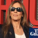 Why young women are having facelifts: ‘I couldn’t even open my eyes. That’s how swollen I was’ | Cosmetic surgery