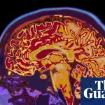 “Extremely dangerous” Hurricane Melissa lashing Cuba after pounding Jamaica