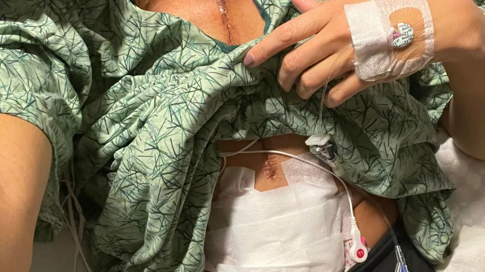 Summer McKesson post surgery scar - Courtesy Summer McKesson