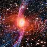 Ichilov doctor contracts measles after treating unvaccinated child