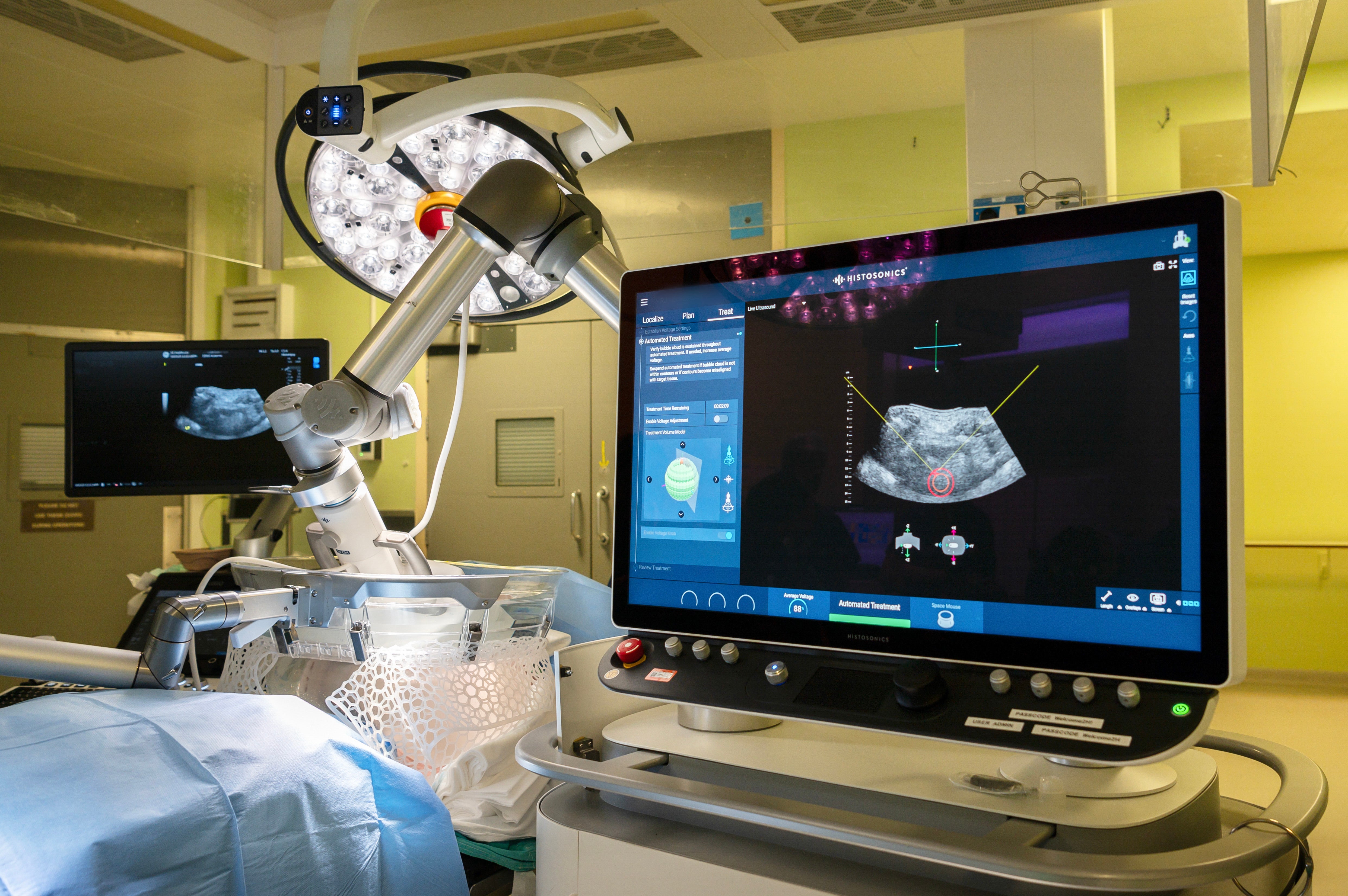 The machine is part of a pioneering new treatment for liver cancer, which uses focused ultrasound waves to destroy the disease.