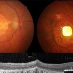 Interstellar comet 3I/ATLAS just zipped by the sun. Discover what’s next