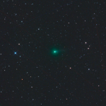 Bengaluru: Doctors see increase in stroke cases among youngsters – Deccan Herald