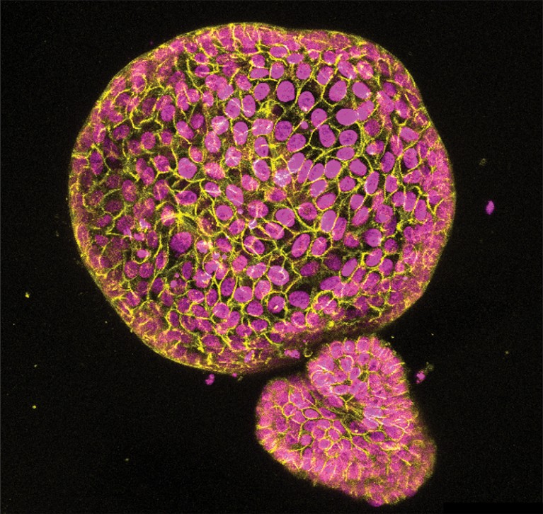 Micrograph of endometrial organoids.