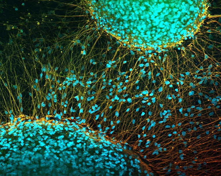 Fluorescence light micrograph of nerve cells that have been derived from induced pluripotent stem cells and look like seeds with small strings.