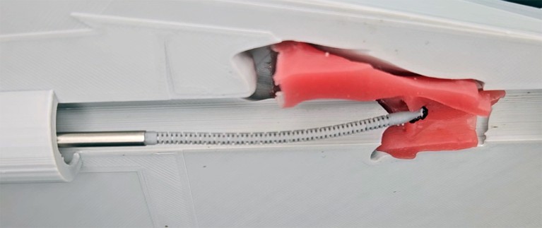 A reconstruction of the robotic bioprinted tool for vocal cord repair shown in a hypothetical surgical setting.