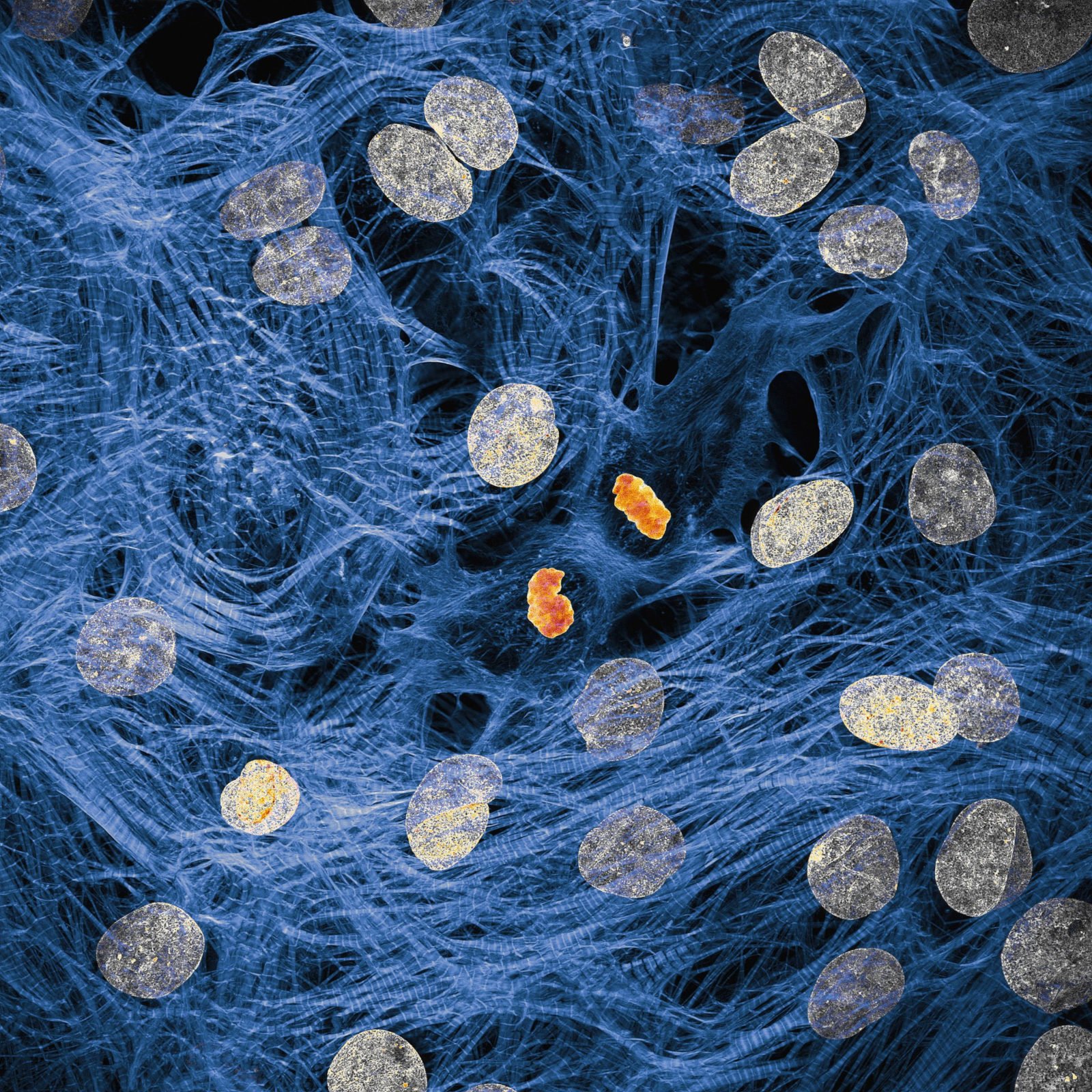 Nikon Micrography James Hayes Heart Muscle Cells