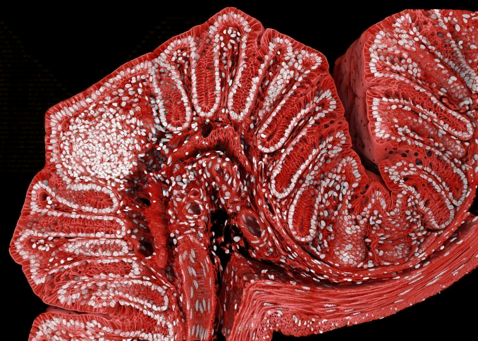 Nikon Micrography Marius Mahlen Mouse Colon