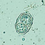 NASA discovered a bacteria that can ‘play dead’—and might have accidentally sent it to Mars
