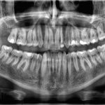 Apple will reportedly shift to OLED displays for MacBooks, iPad Air and Mini