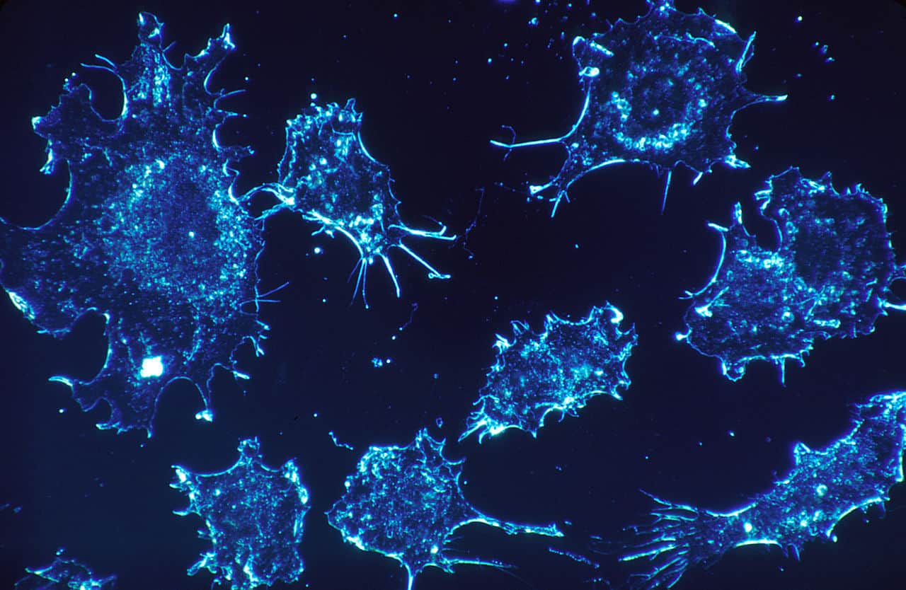  Scientists Found a Way to Use LED to Zap Cancer Cells and Leave Healthy Ones Unscathed