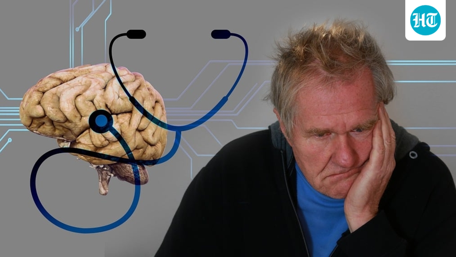  Neuroscientist shares 3 major risk factors for developing Alzheimer’s disease: Vitamin deficiency, inflammation, more