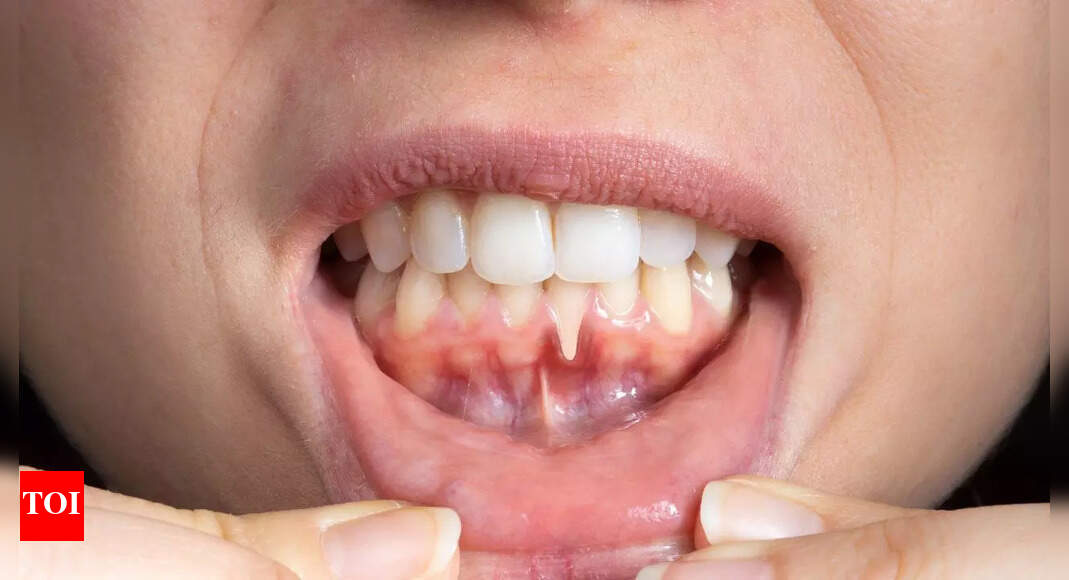  8 health problems that show up in your teeth and gums: What your smile reveals about your wellness |