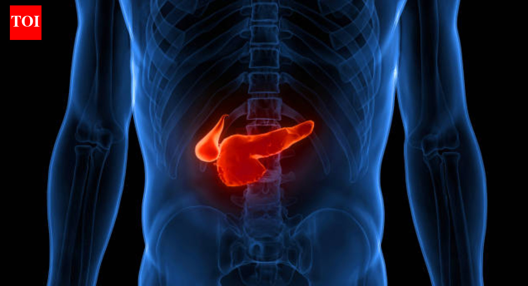  The deadliest cancer you rarely notice: Doctor explains why pancreatic cancer is so hard to catch |