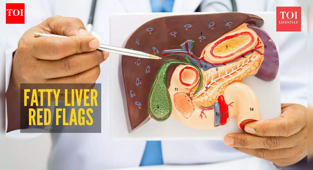  Fatty Liver Symptoms: Harvard-trained doctor lists warning signs of fatty liver that one should never miss |