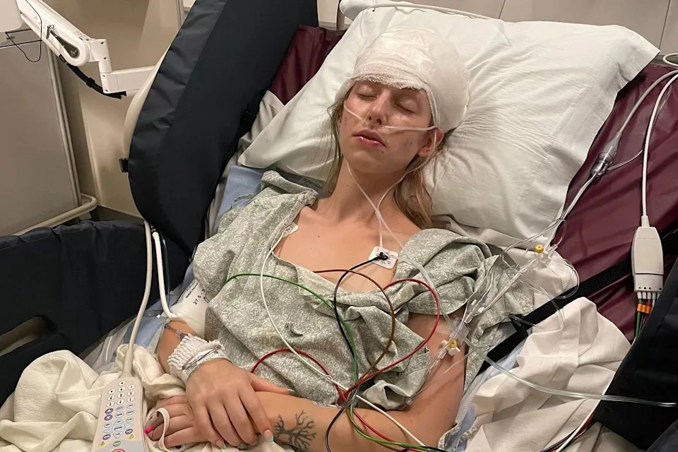 SWNS Kelsey Stoksted recovers in the hospital after undergoing brain surgery.