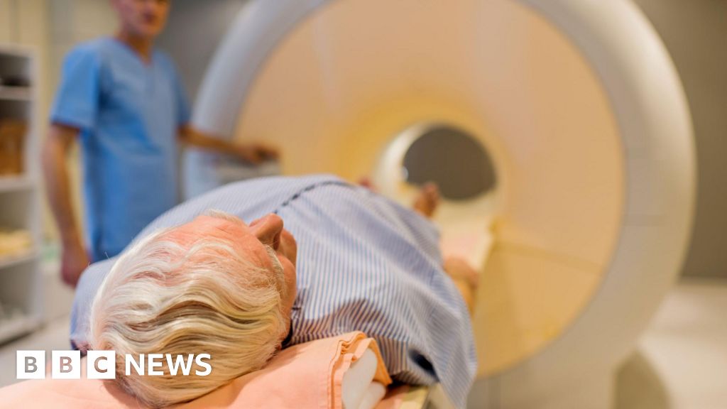  Prostate cancer screening trial to recruit thousands of men