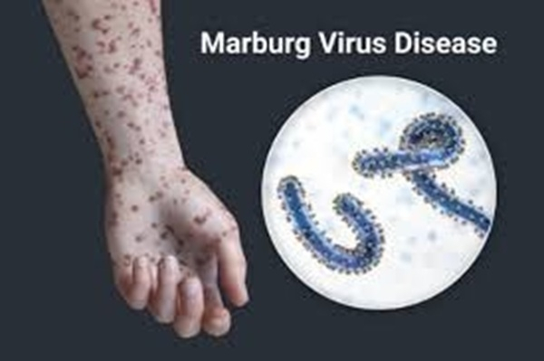  Ghana on high alert as Marburg virus outbreak in Ethiopia sparks precautions