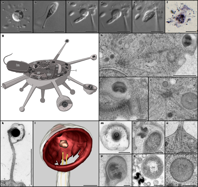  Rare microbial relict sheds light on an ancient eukaryotic supergroup