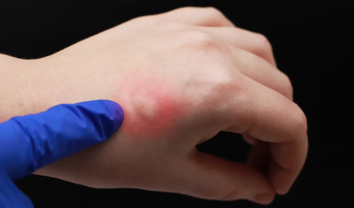  Authorities sound alarm after disease-carrying threat spreads across US region — here’s what you need to know