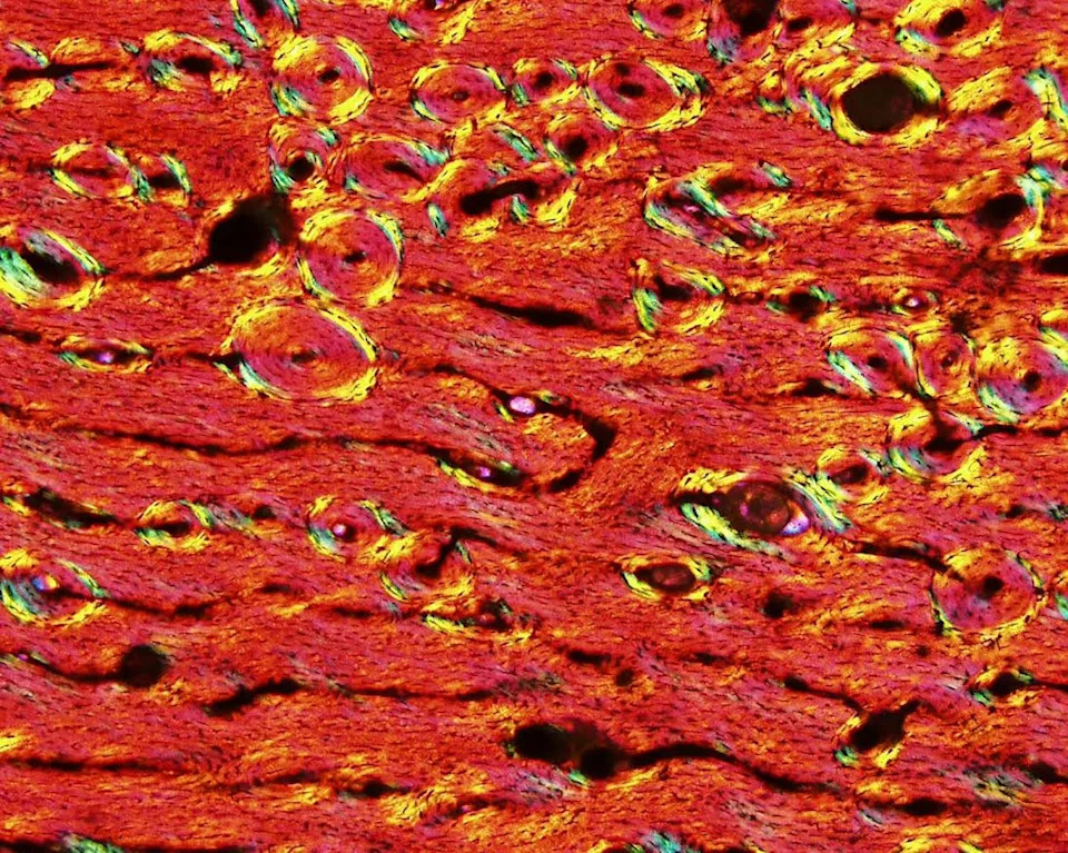 A microscopic image showing both horizontal wavy spaces and circular spaces against a solid background.