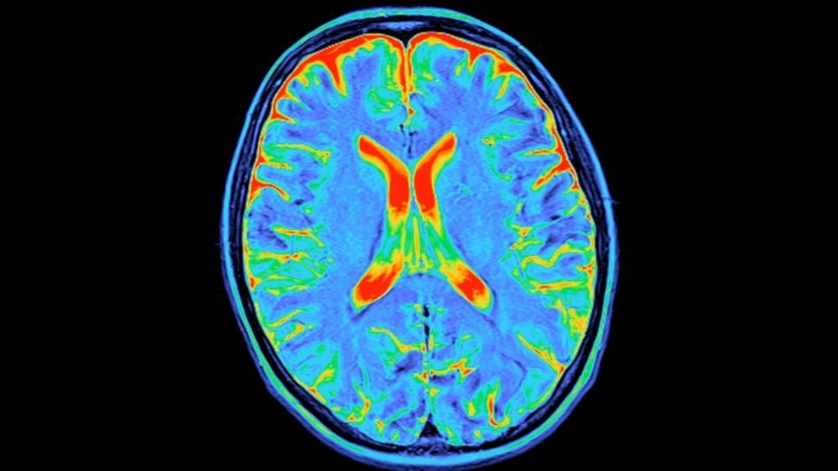  Your Brain Goes Through 5 Distinct Epochs, Massive Study Finds : ScienceAlert