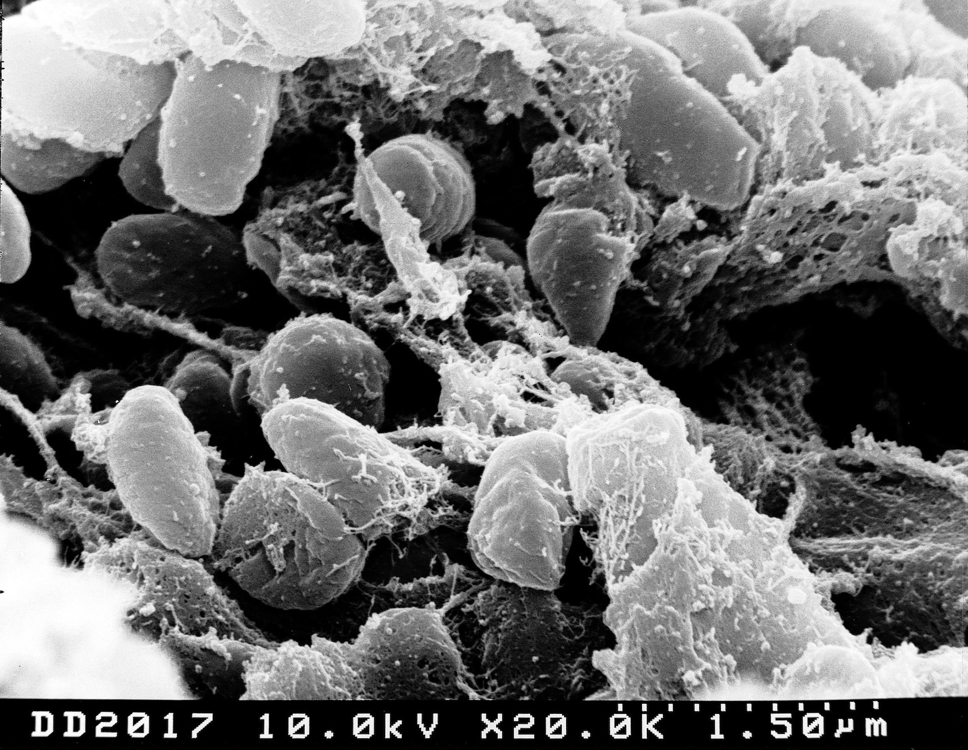 a black and white electron microscope image of bacteria