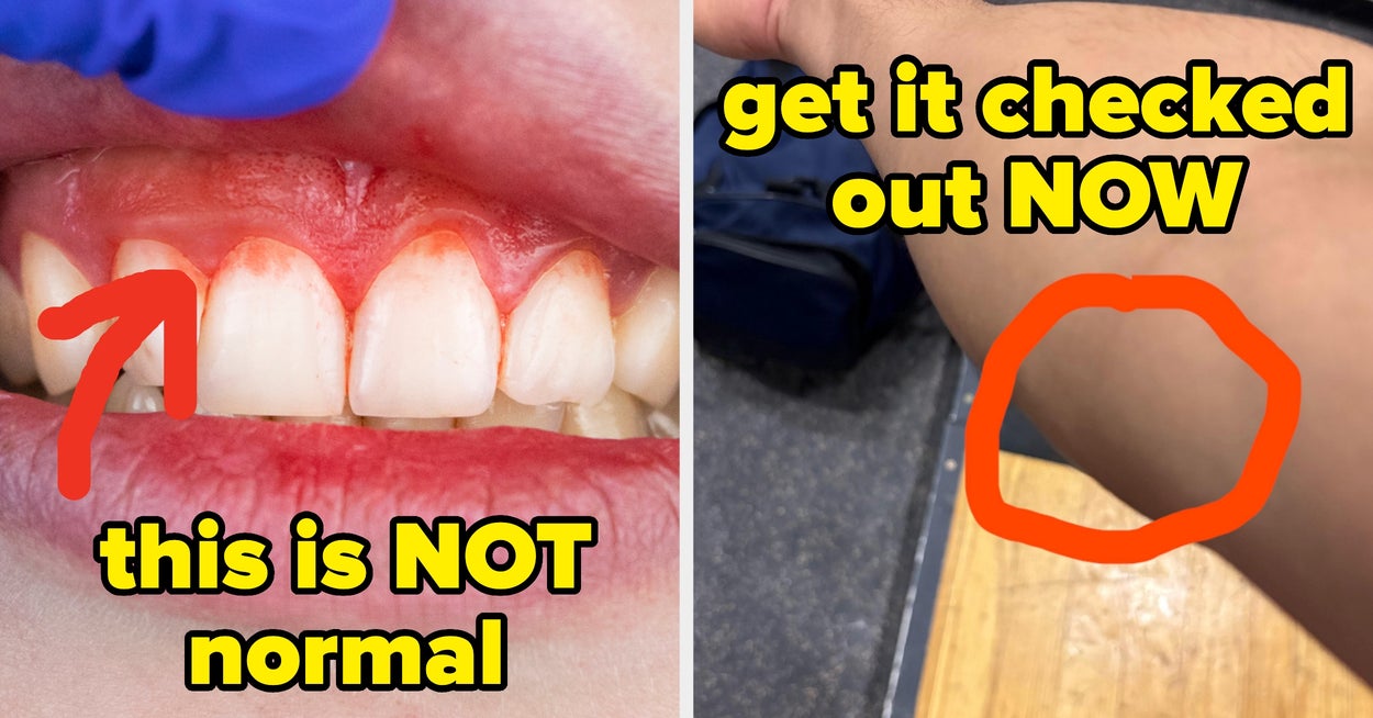  19 Doctors Share Health Signs You Shouldn’t Ignore