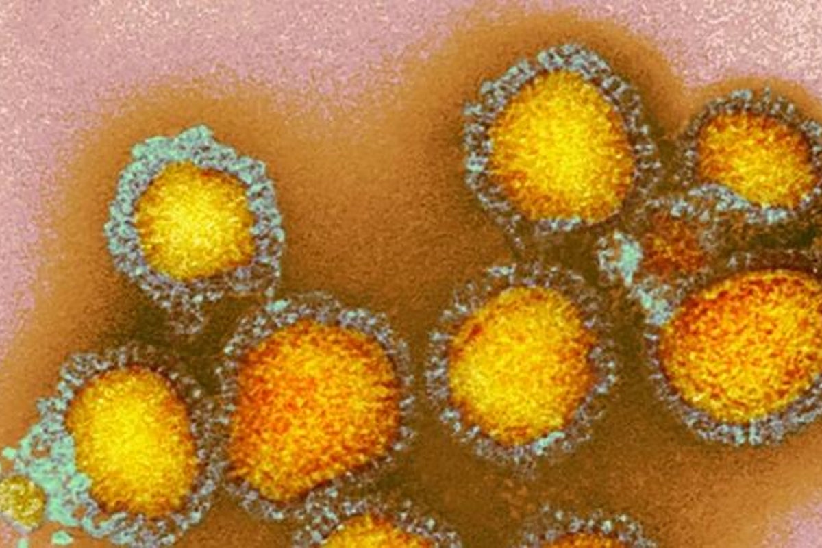  Experts warn of ‘severe’ flu season with fears over new strain