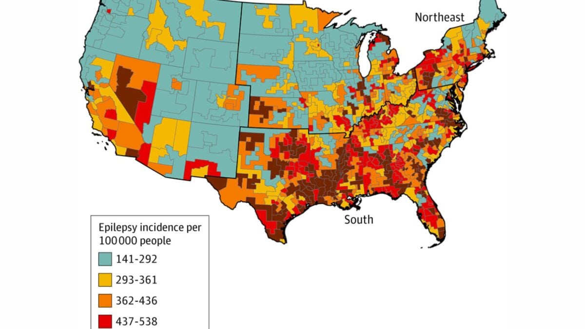  These States Have the Highest Rates of Epilepsy, and Scientists Think They Know Why