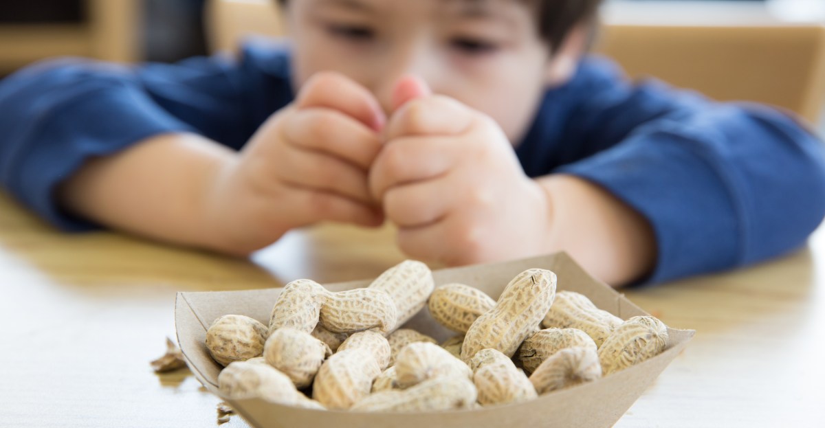  New data: Early peanut feeding is cutting kids’ food allergies