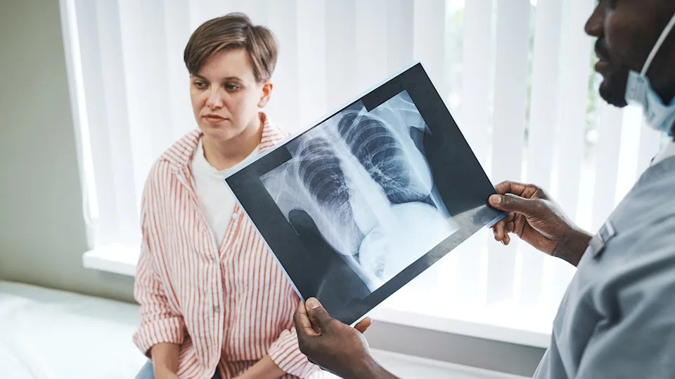 Doctor with x-ray of lungs, standing in front of patient.