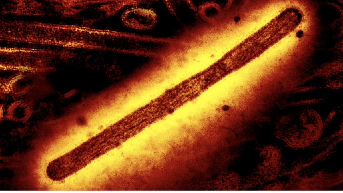  World’s First Death From H5N5 Bird Flu Strain Reported in US : ScienceAlert