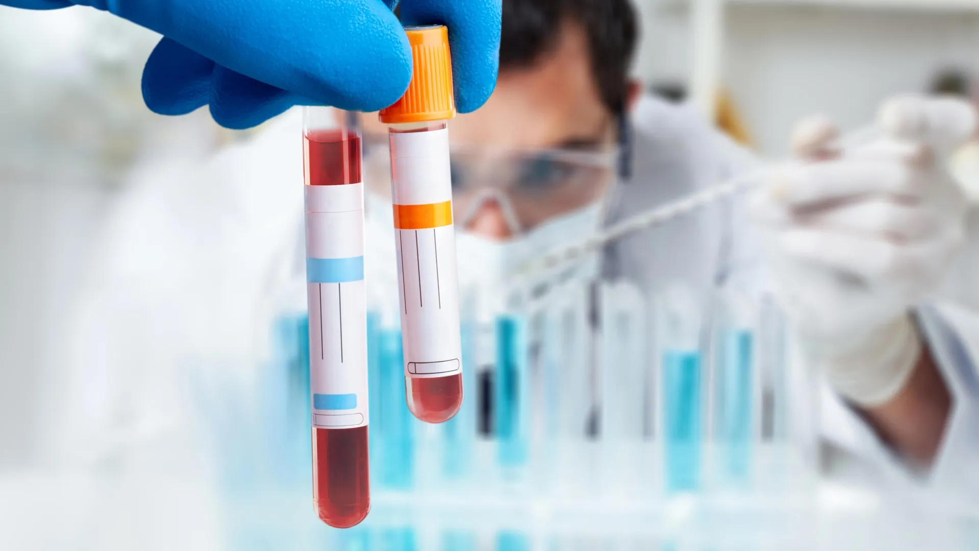  Breakthrough blood test finally confirms Chronic Fatigue Syndrome