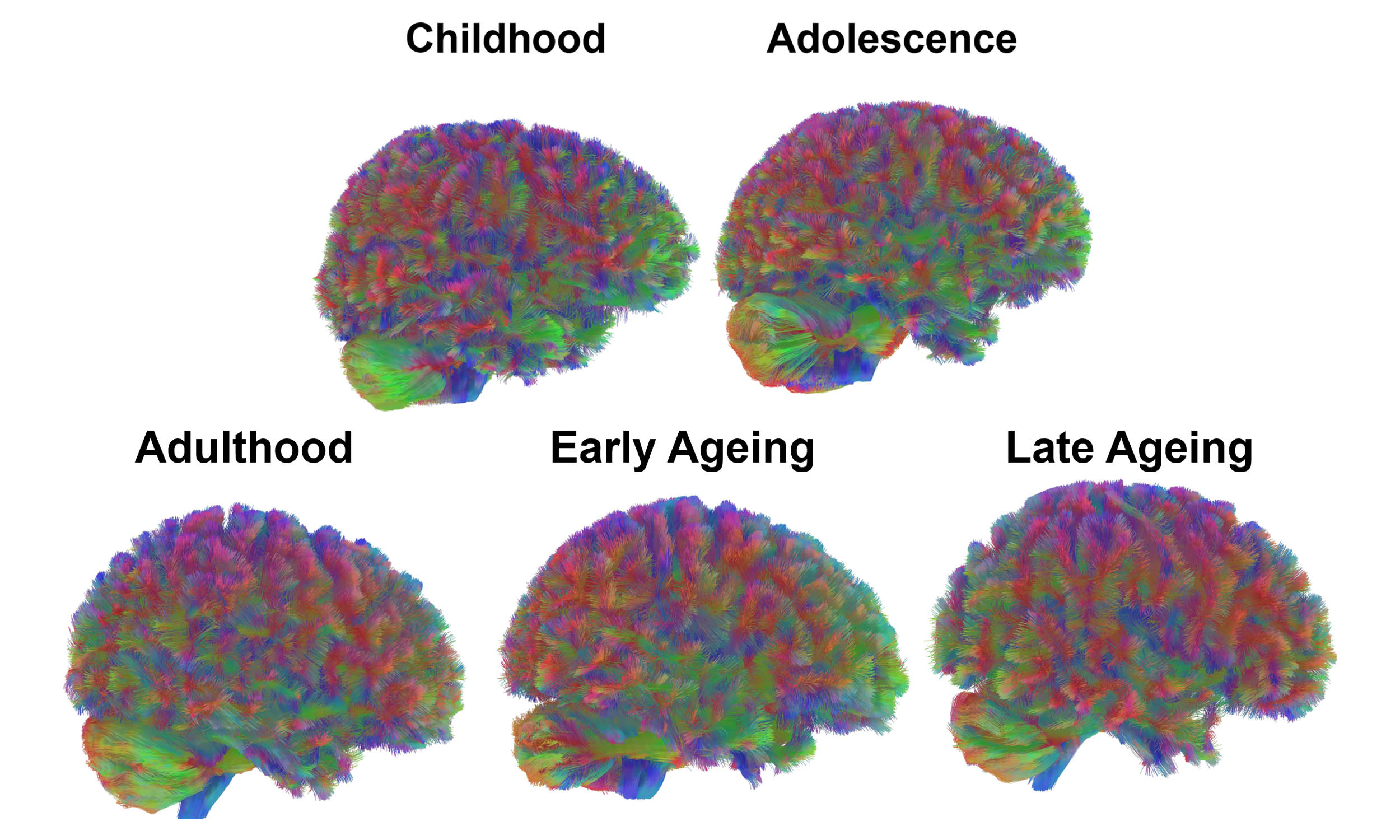  Scientists map five distinct stages of human brain aging