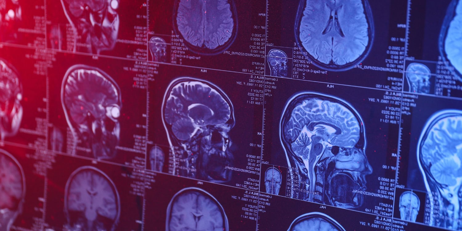  Anxiety disorders linked to lower levels of key nutrient