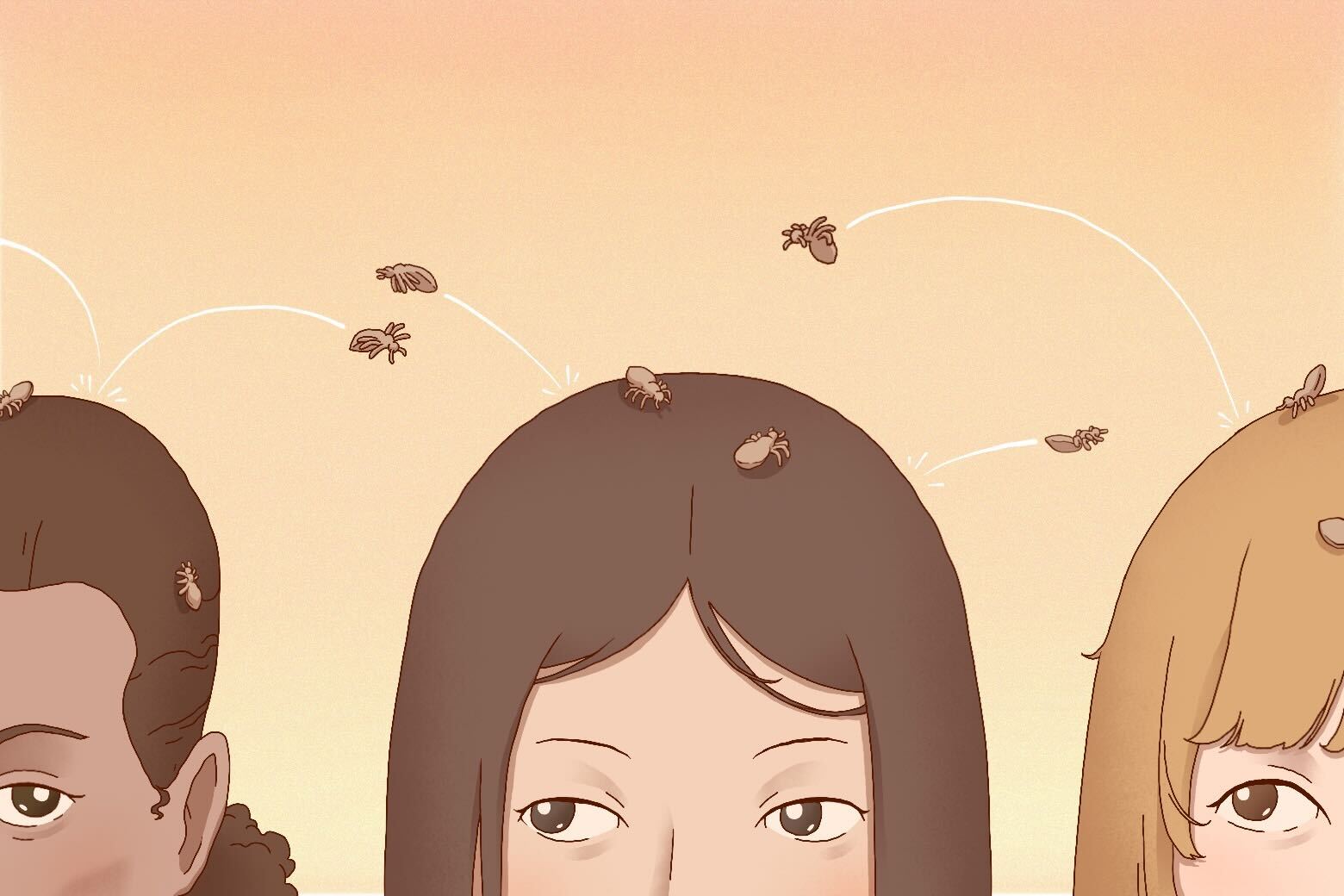  Head lice have an upside. Trust me on this.