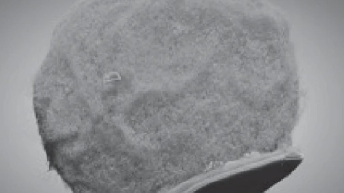  Tiny chips hitch a ride on immune cells to sites of inflammation