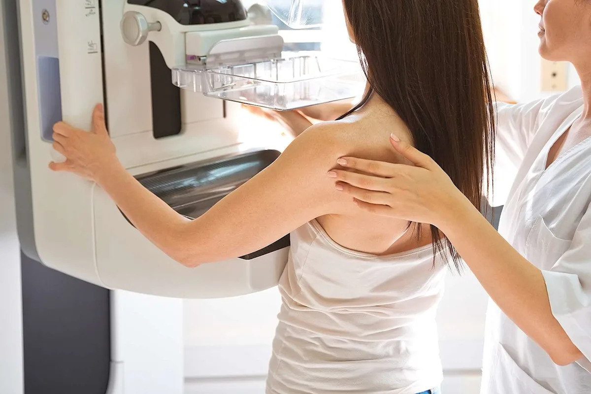  AI Mammograms Can Predict Breast Cancer Risk
