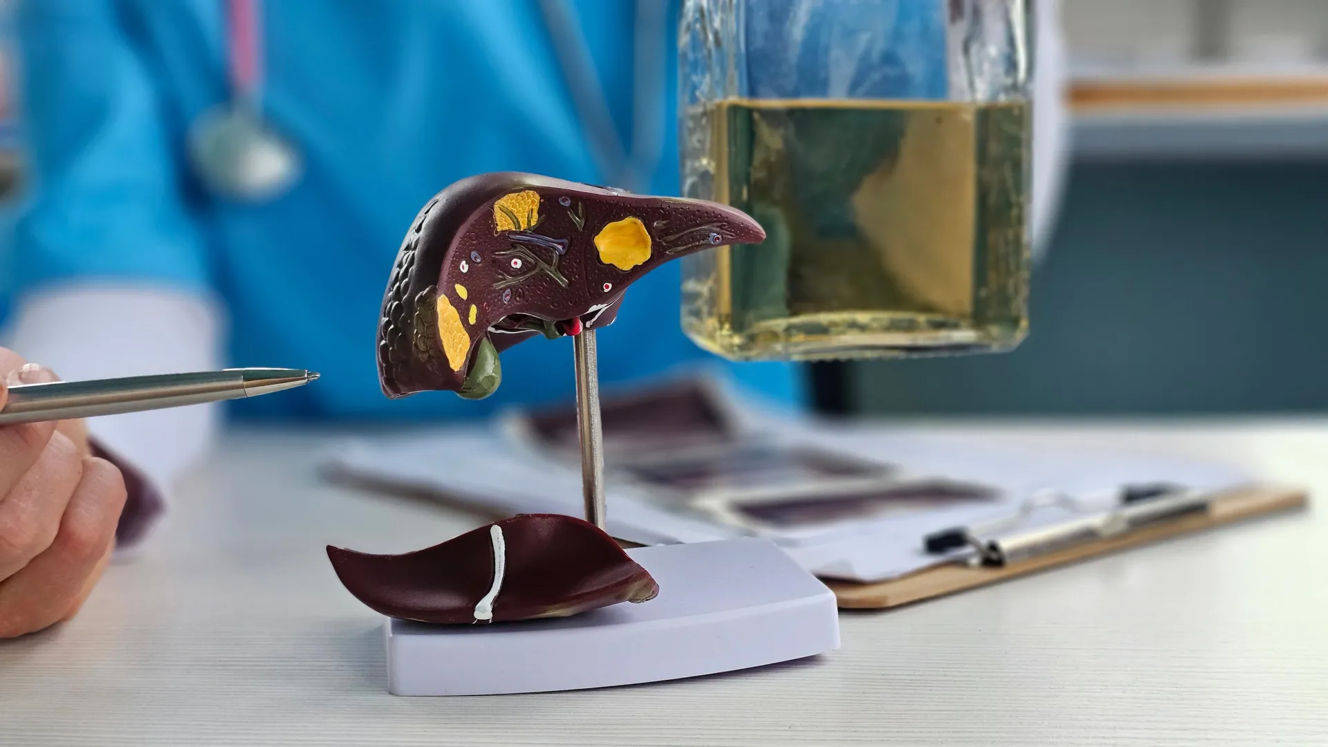  Blocking one enzyme may break the link between alcohol and liver disease