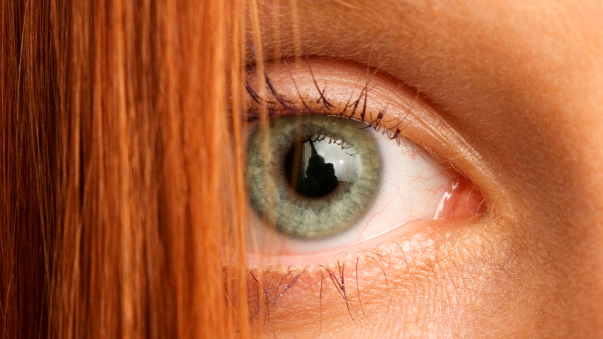  Red Hair Gene Could Explain Why Some Wounds Never Heal : ScienceAlert