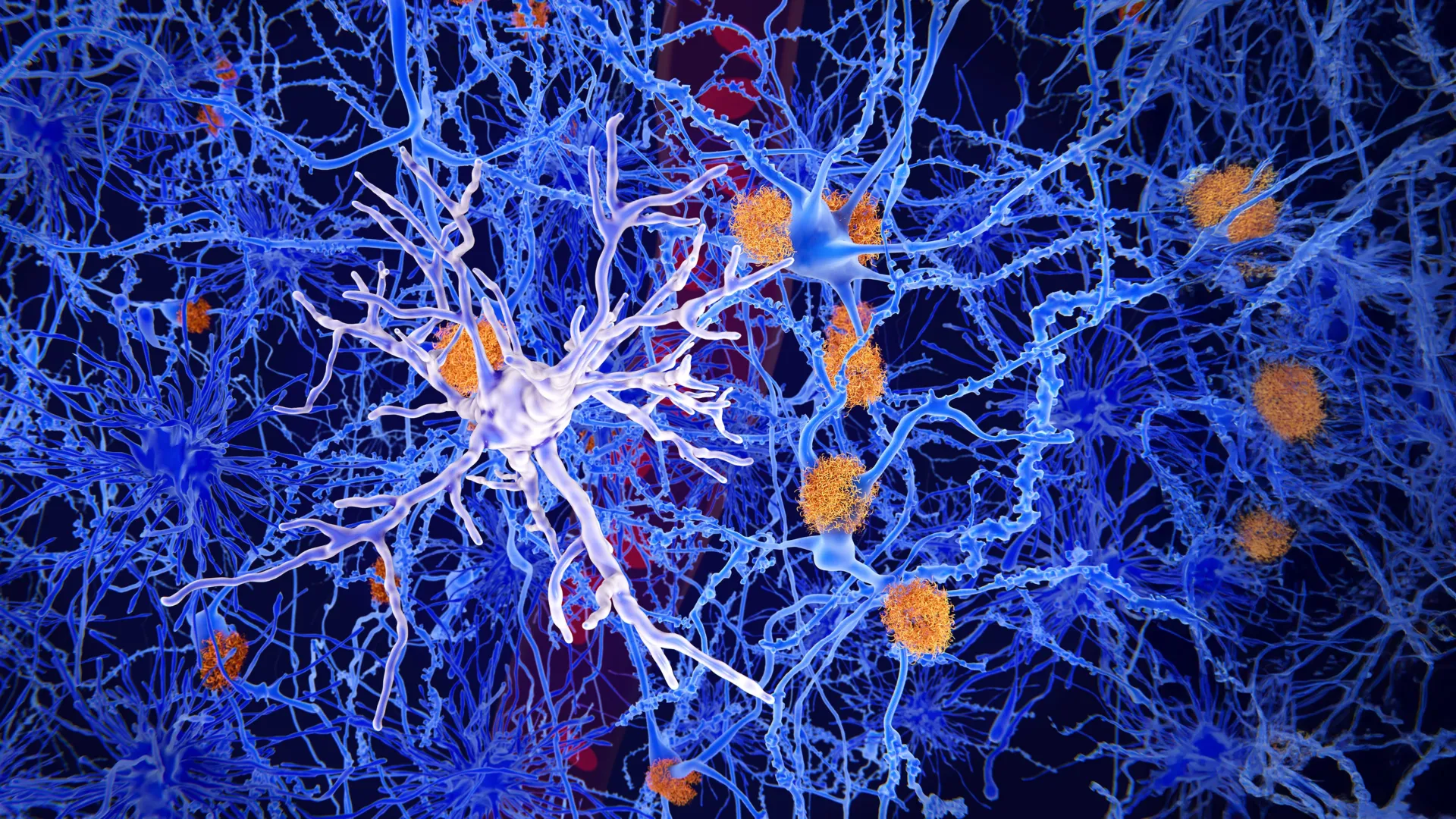  Scientists find brain cells that could stop Alzheimer’s
