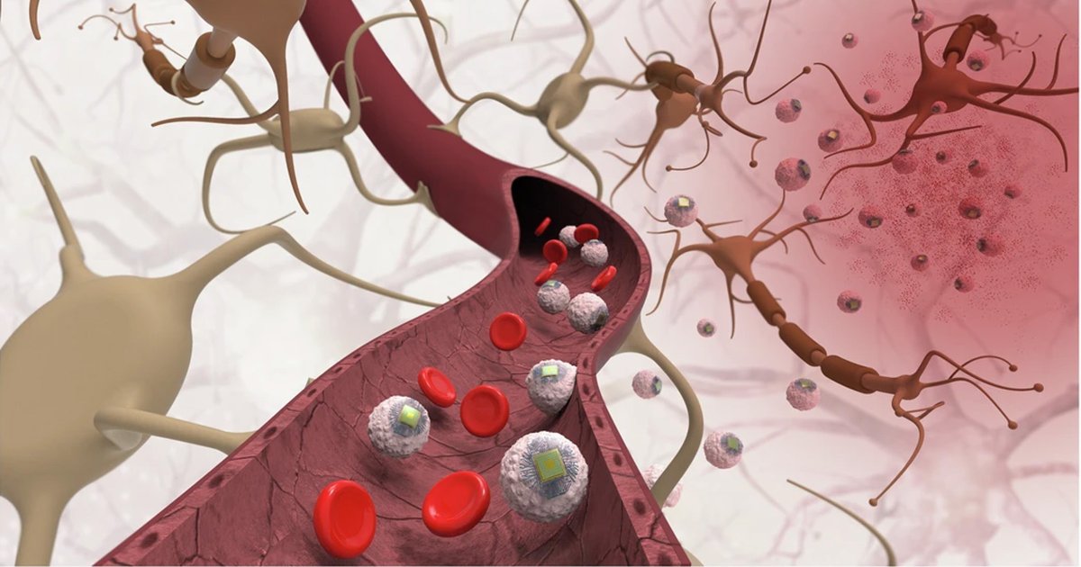  MIT Invents Injectable Brain Chips