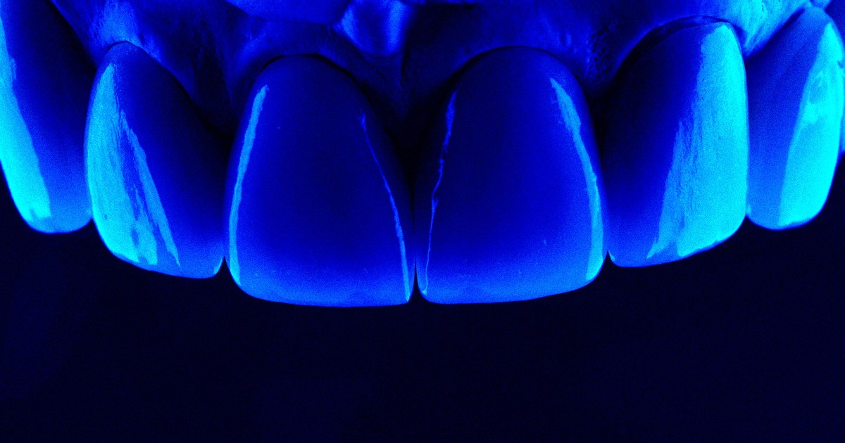  Scientists Say They’ve Figured Out a Way to Regrow Tooth Enamel
