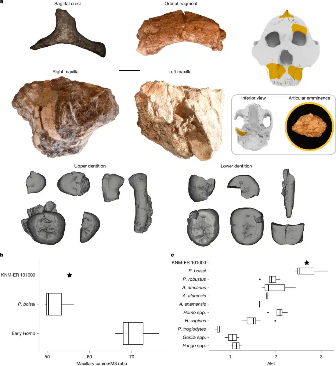 Remains Of The Skull And Teeth
