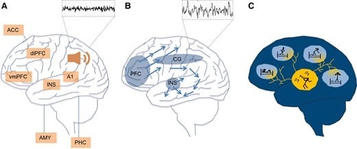Topographic Overlap Of Brain Areas Involved In Tinnitus And Nrem Sleep